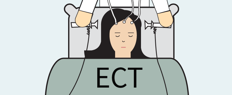 전기경련요법(ECT, electroconvulsive therapy) : 전류가 뇌를 통과하여 뇌의 신경 전달 물질의 기능과 효과에 영향을 주어 우울증을 완화시킵니다.